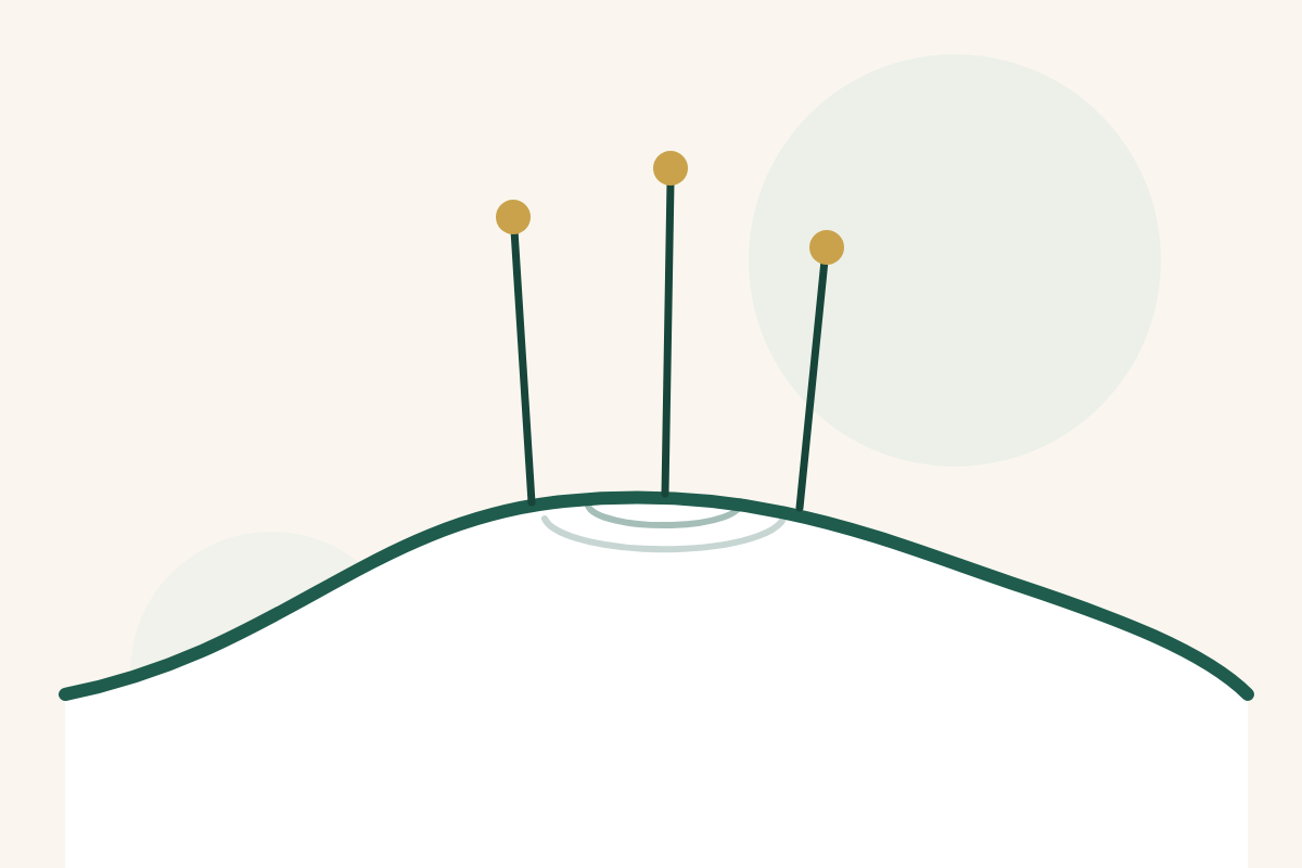 Illustration: feine Akupunkturnadeln auf einer Rückenlinie