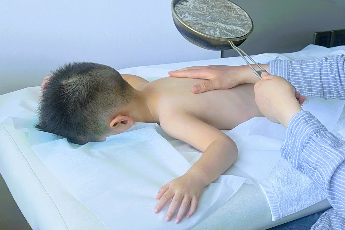 孩子俯卧于治疗床上，艾灸温灸盘在其背部上方缓缓移动